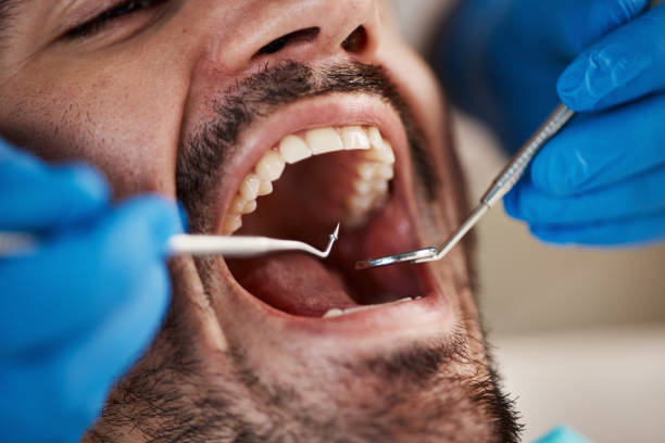 Best Urgent Tooth Repair  in Decatur, AL
