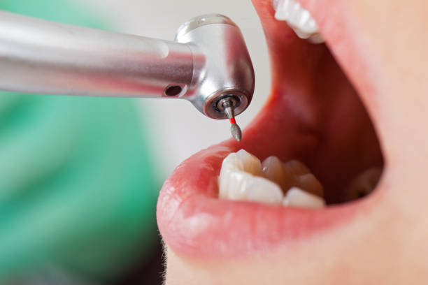 Emergency Dentist Open Today in AL